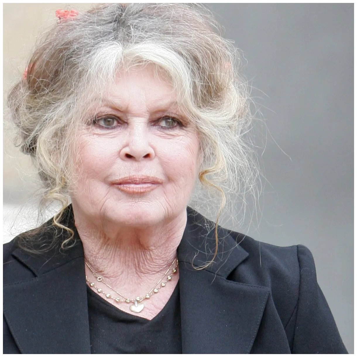 What plastic surgery has had? plastic surgery bio