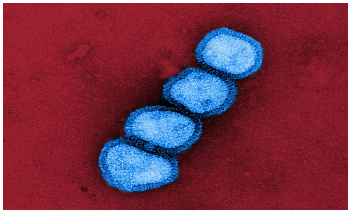 Épidémie de grippe : Pourquoi une telle ampleur cet hiver