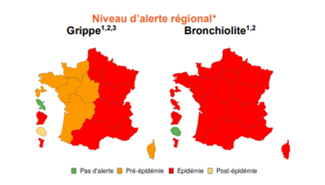 Grippe. La région entre dans une phase épidémique - Oise Hebdo