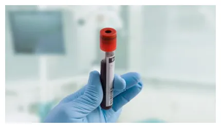 Hémorroïdes internes causes, symptômes, traitements femme actuelle