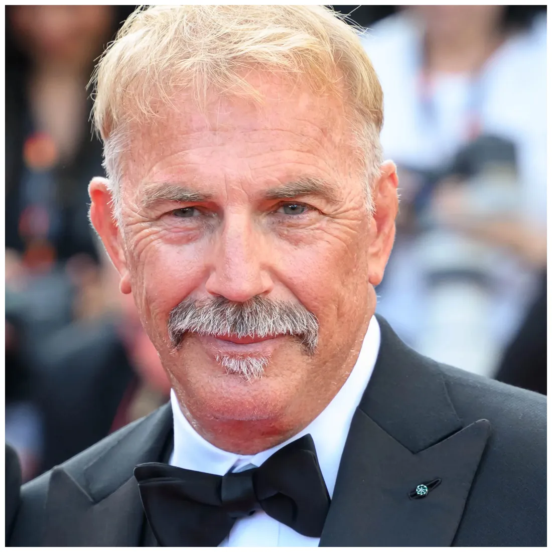 Kevin Costner Hair Transplant - Hair Transplant Turkey | Turkeyana