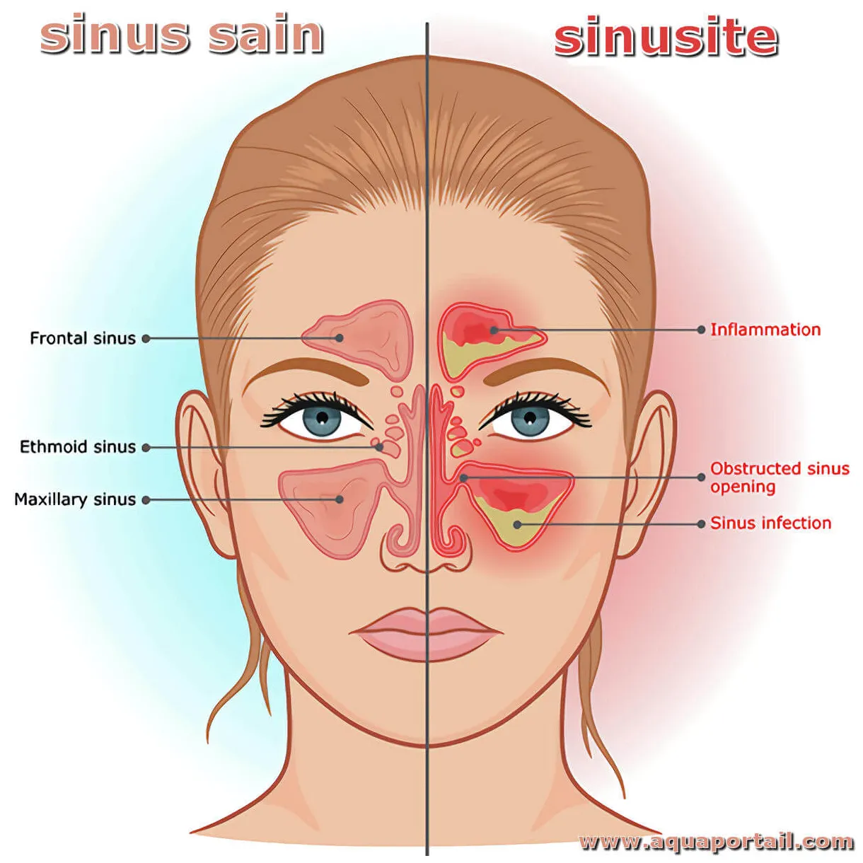 Sinus carotidien : définition et explications