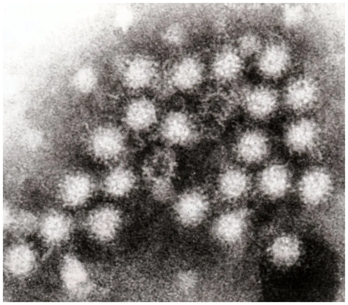 Norovirus disease outbreak control division