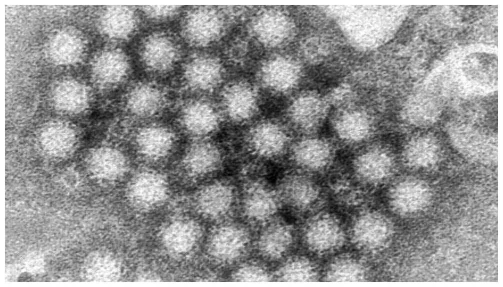 Norovirus outbreaks surge; experts stress hygiene and disinfection