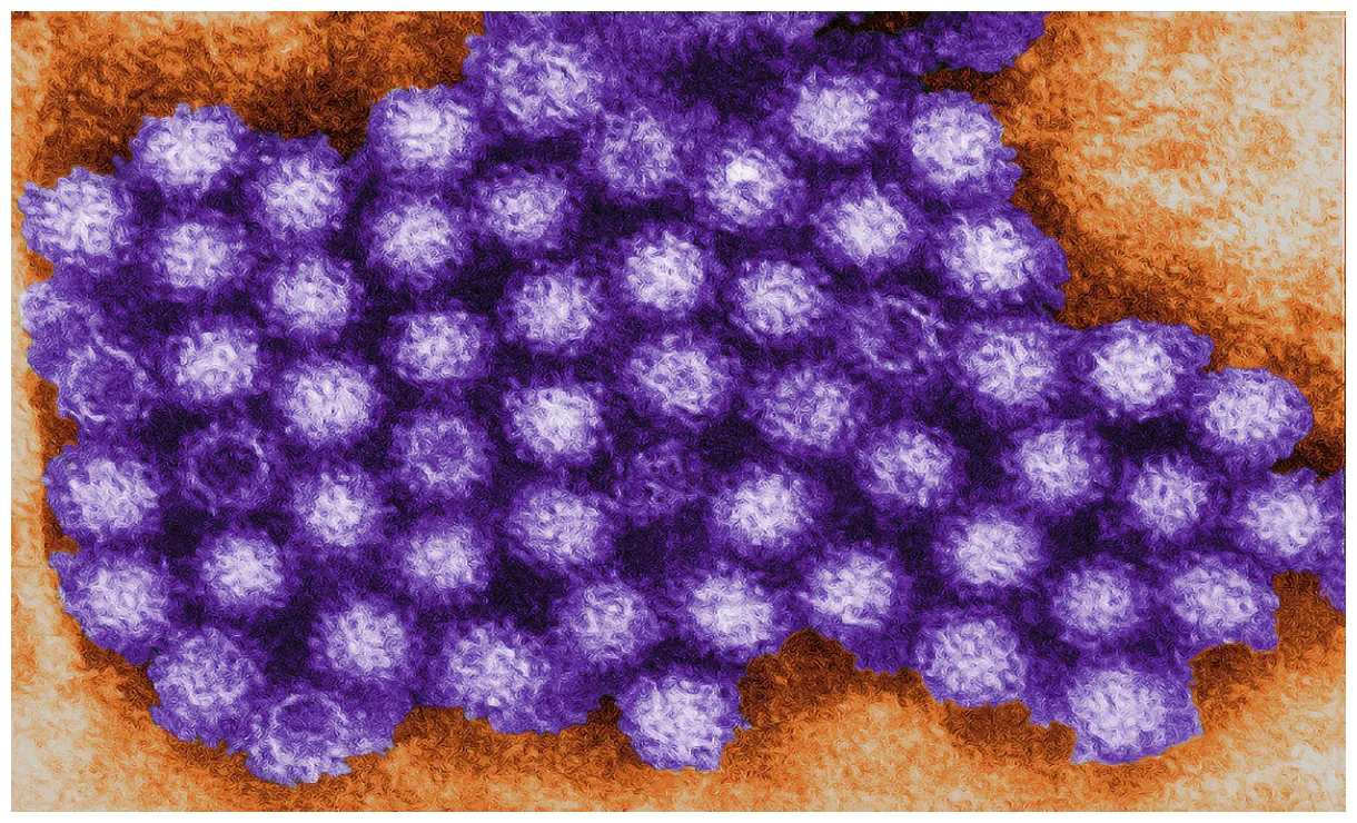 What is new norovirus strain sweeping the uk? the independent