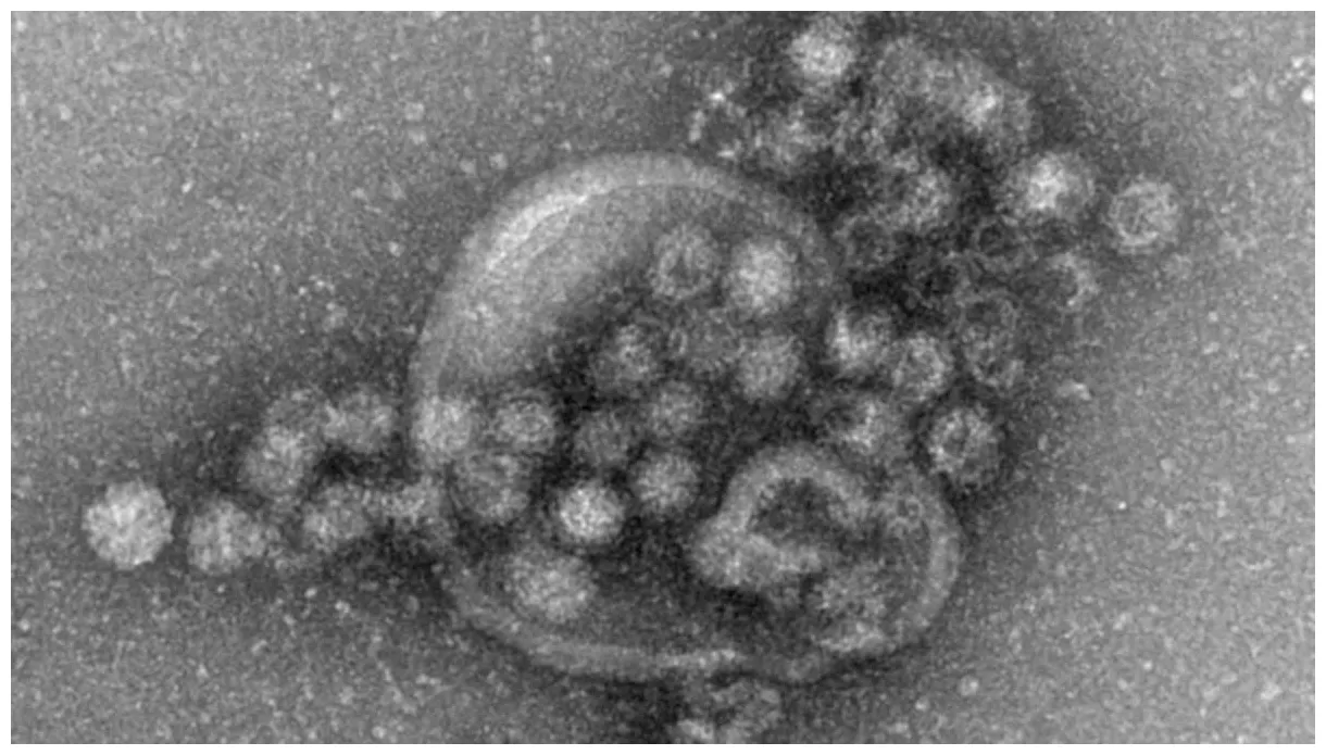 Norovirus-welle neue norovirus-variante an vielen