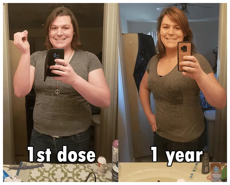 1st dose vs. 1 year hrt mtf, 30, 6', 238->228 lbs r/transtimelines