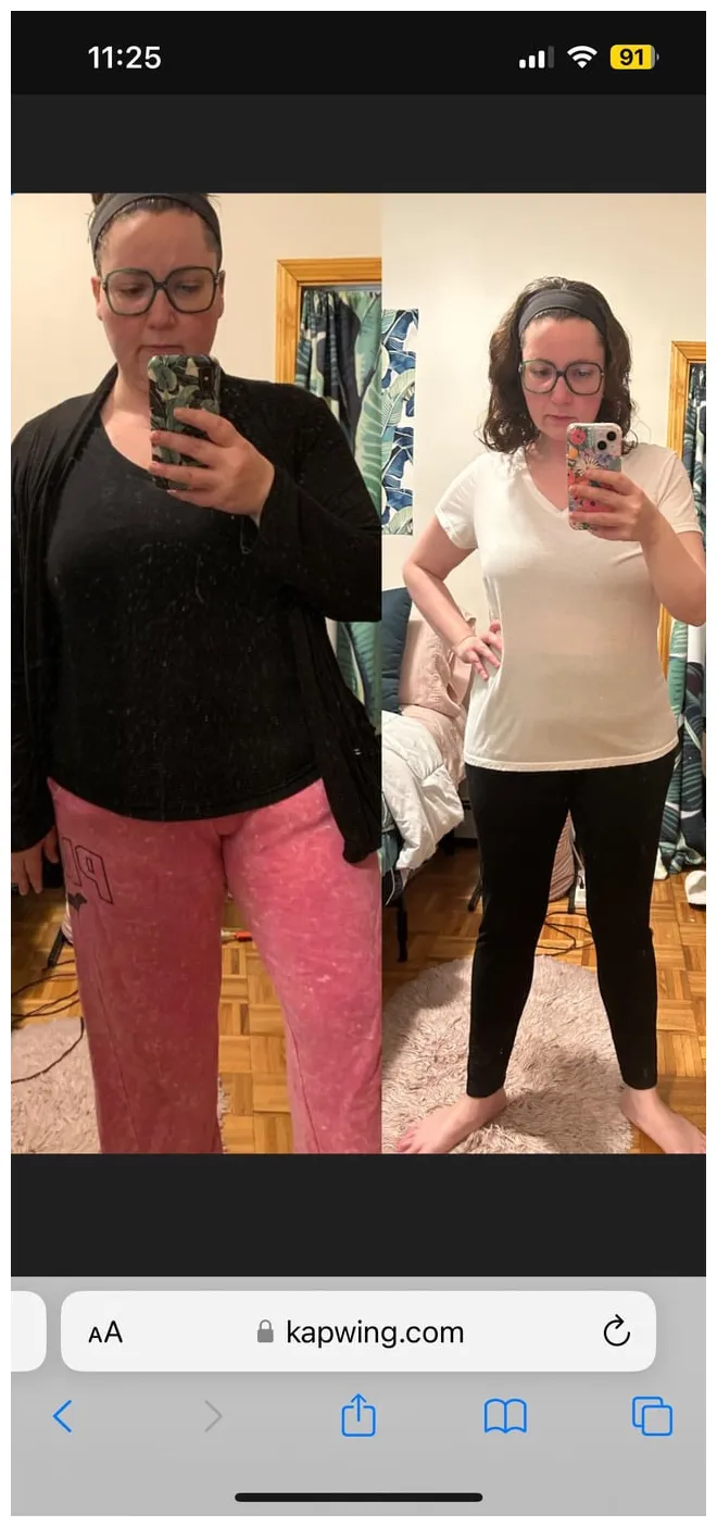 Nine-months post-op! r/gastricsleeve