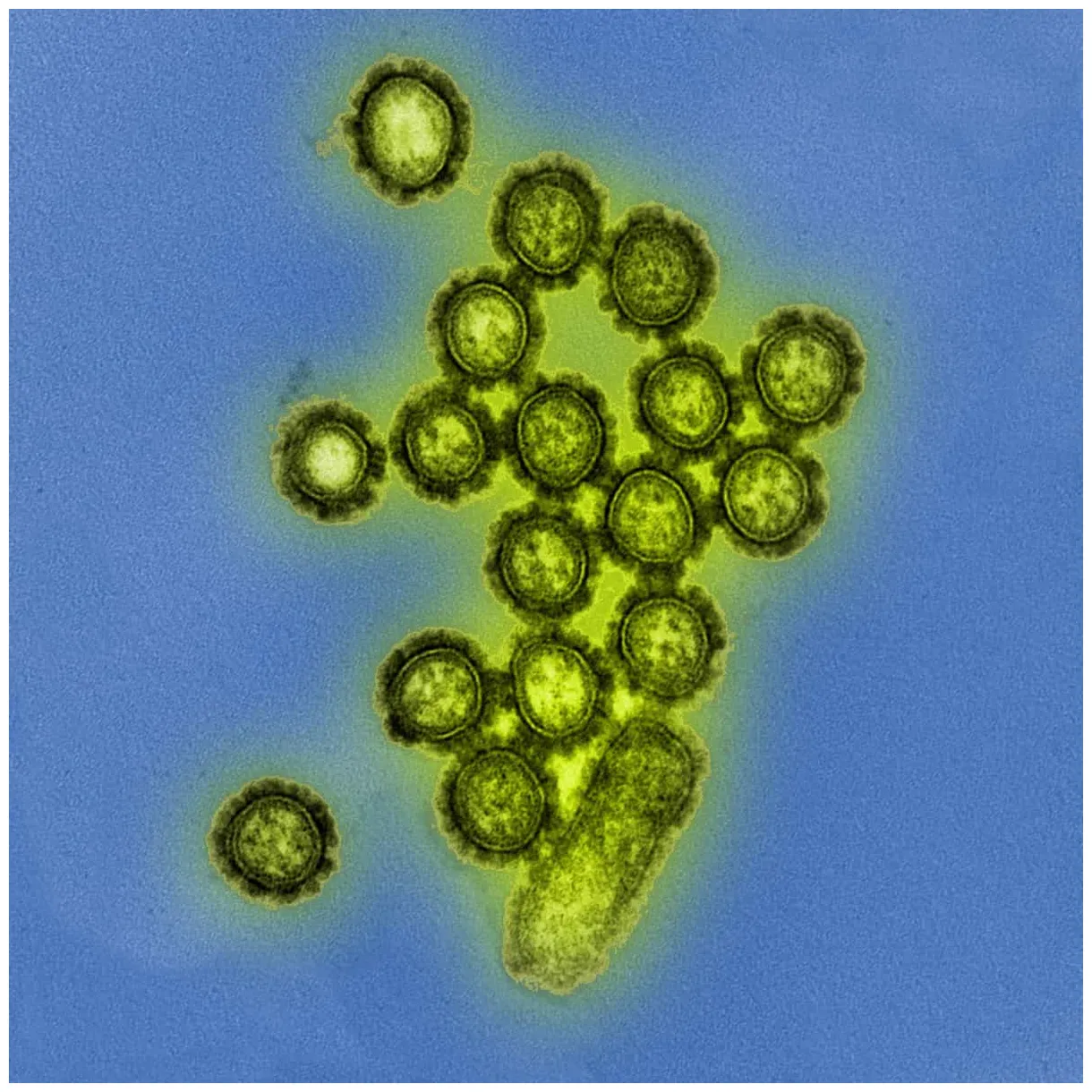 Recommandations sur la grippe saisonnière 2025 recomédicales
