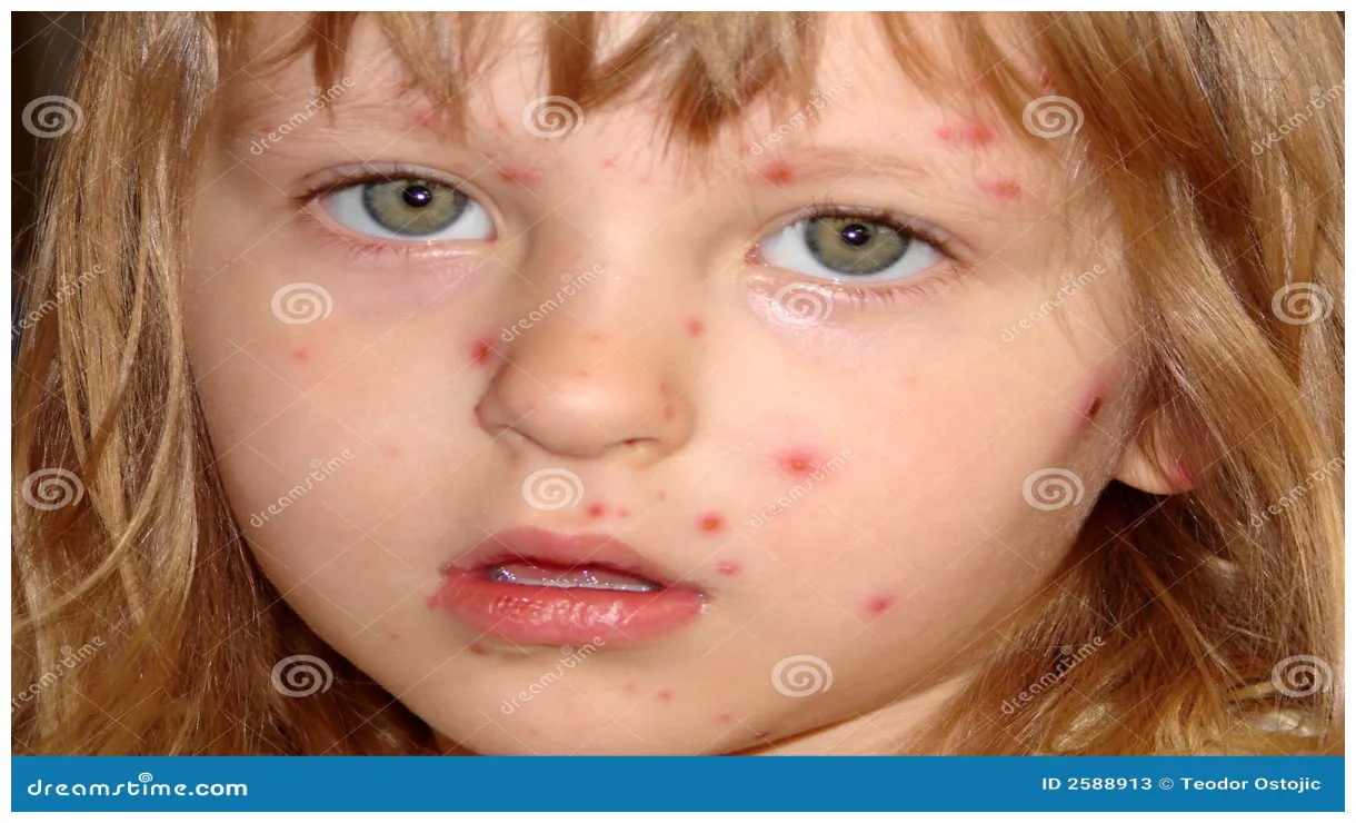 Stock afbeelding. of professioneel, virus 2588913