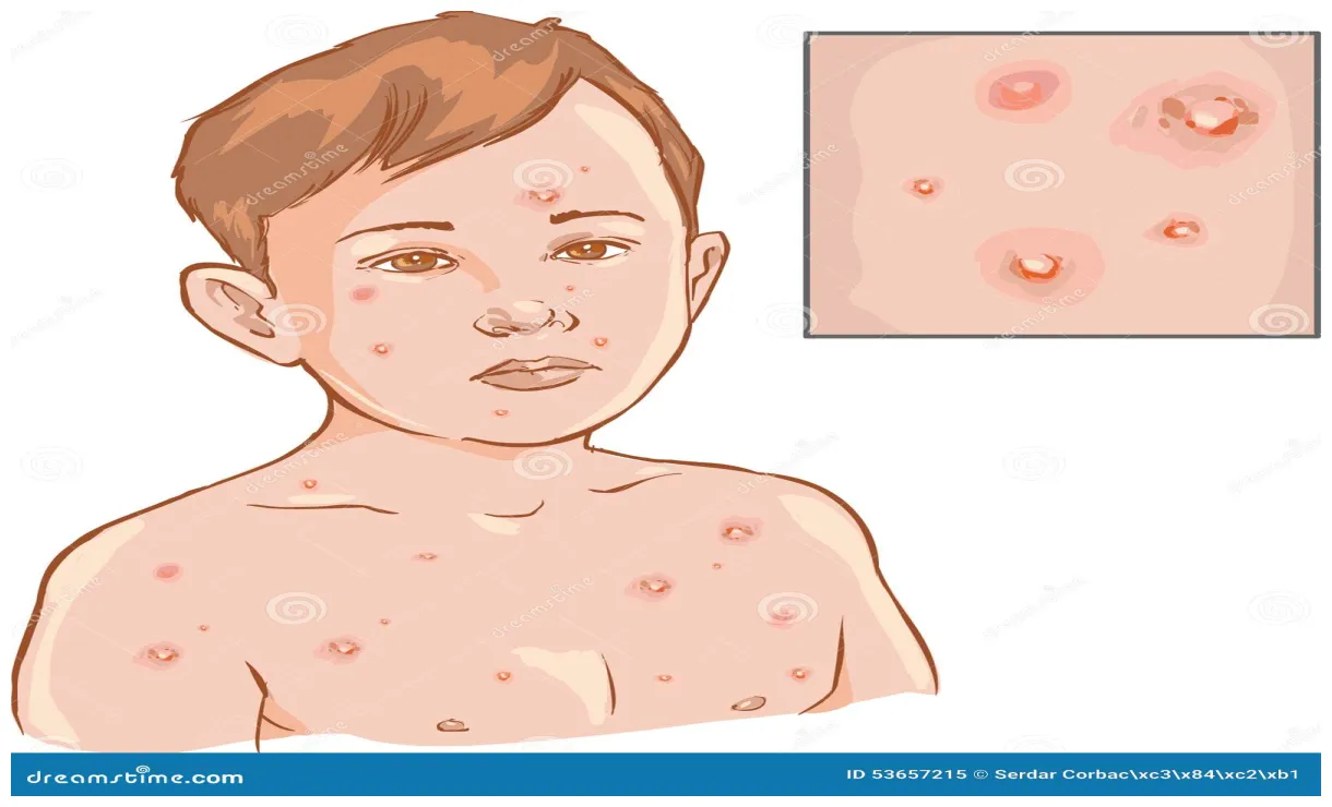 Vector illustratie. illustration of lichaam 53657215