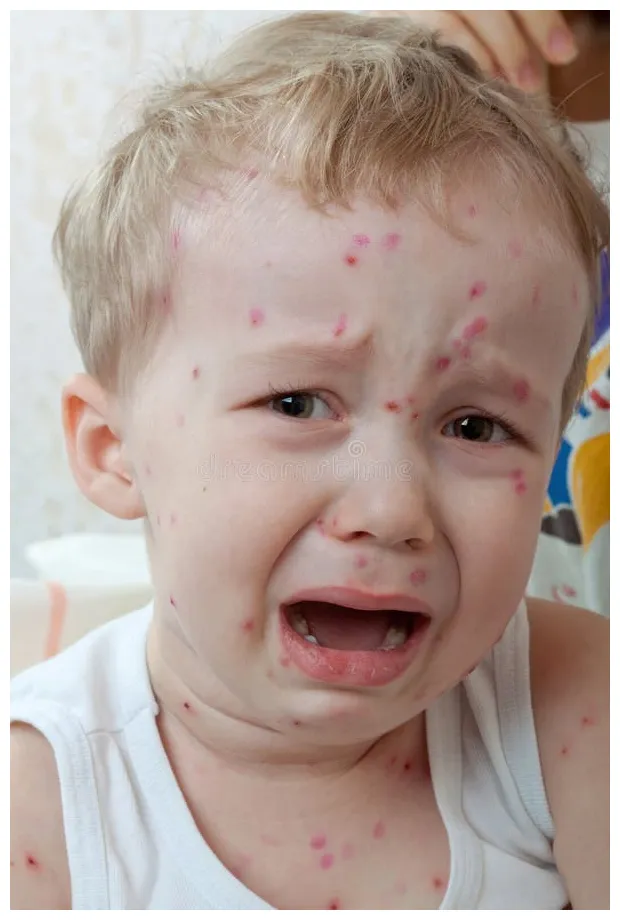 Stock afbeelding. of zweer, besmetting 22851563