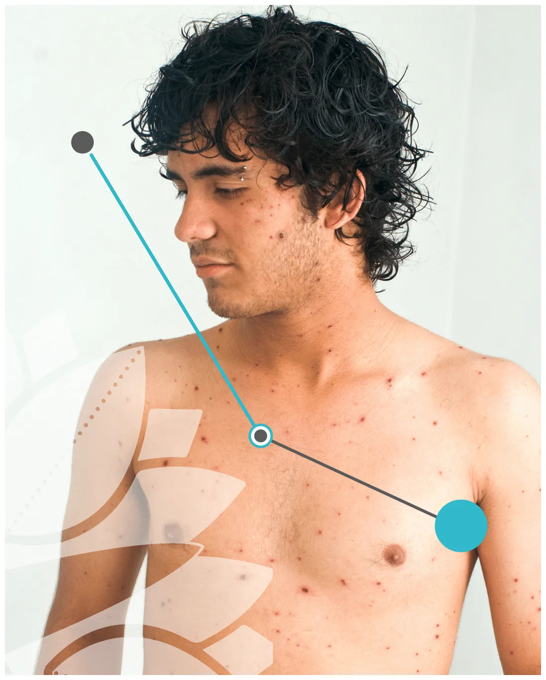 Starfish.health aandoening ziek virus