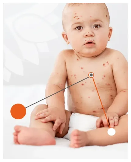 Starfish.health aandoening ziek virus